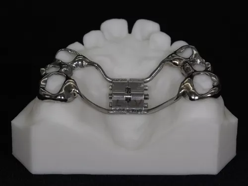 支架式螺旋扩弓器 - 祥舒齿科