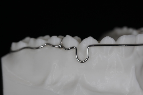 环绕式比格保持器02.jpg