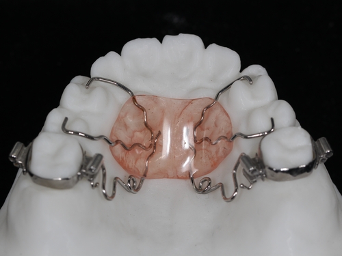 功能性牙齿矫正器图片图片